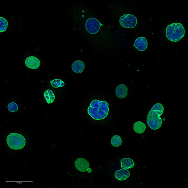 Una nueva terapia genica para el envejecimiento